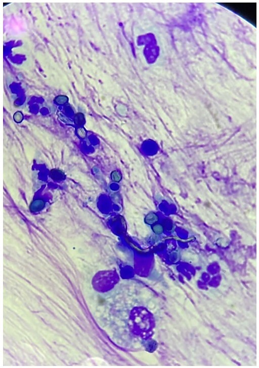 Pulmonary aspergillosis in a horse: a case report.