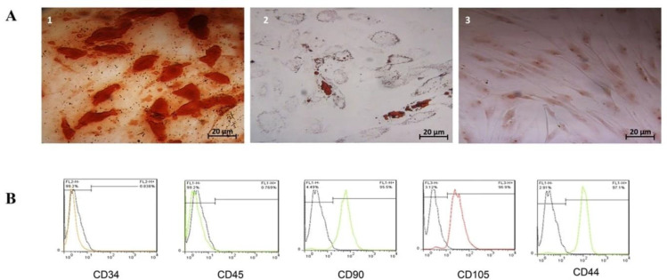 Effectiveness of human adipose tissue-derived mesenchymal stem cells expressing alpha-1 antitrypsin gene in liver fibrosis: a study in mice.