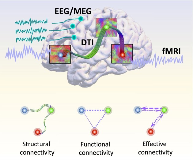 Exploring Alzheimer's disease: a comprehensive brain connectome-based survey.