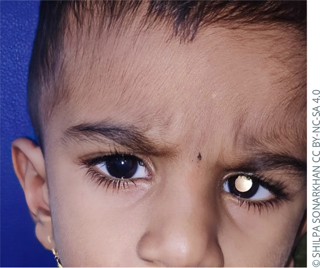 Detecting vision problems in children.