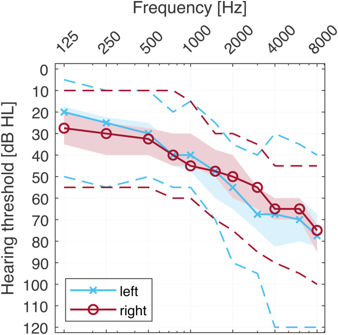 Benefit of Hearing-Aid Amplification and Signal Enhancement for Speech Reception in Complex Listening Situations.