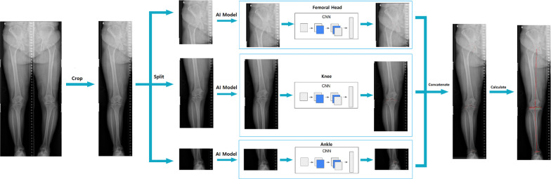 Enhanced deep learning model enables accurate alignment measurement across diverse institutional imaging protocols.