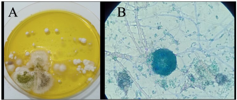 Pulmonary aspergillosis in a horse: a case report.