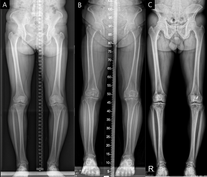 Enhanced deep learning model enables accurate alignment measurement across diverse institutional imaging protocols.
