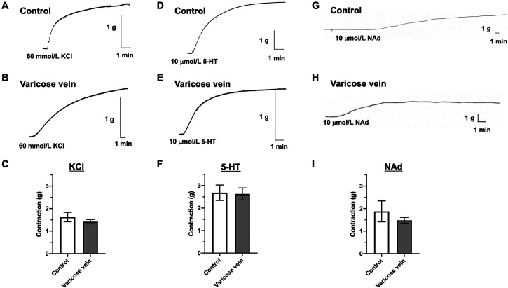Relationship between internal diameter and vasoconstriction in human varicose veins.