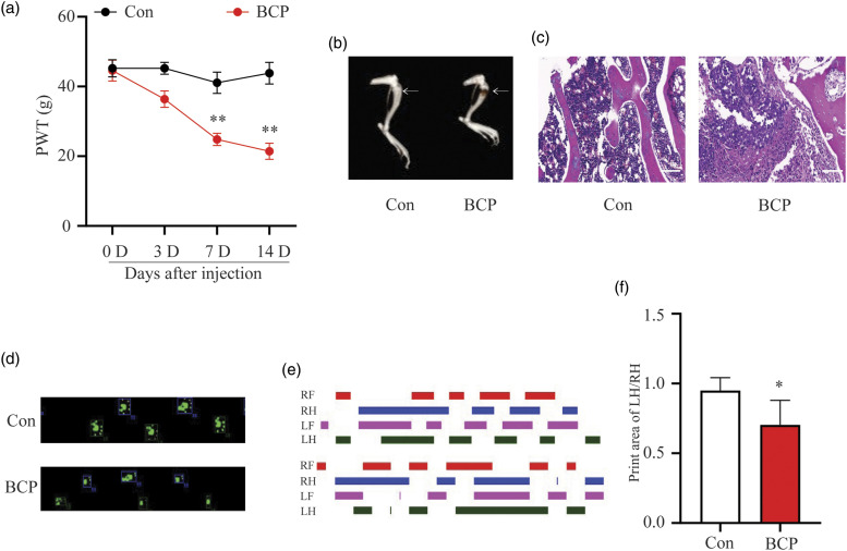 Fat mass and obesity-related protein contributes to the development and maintenance of bone cancer pain in rats by abrogating m6A methylation of RNA.