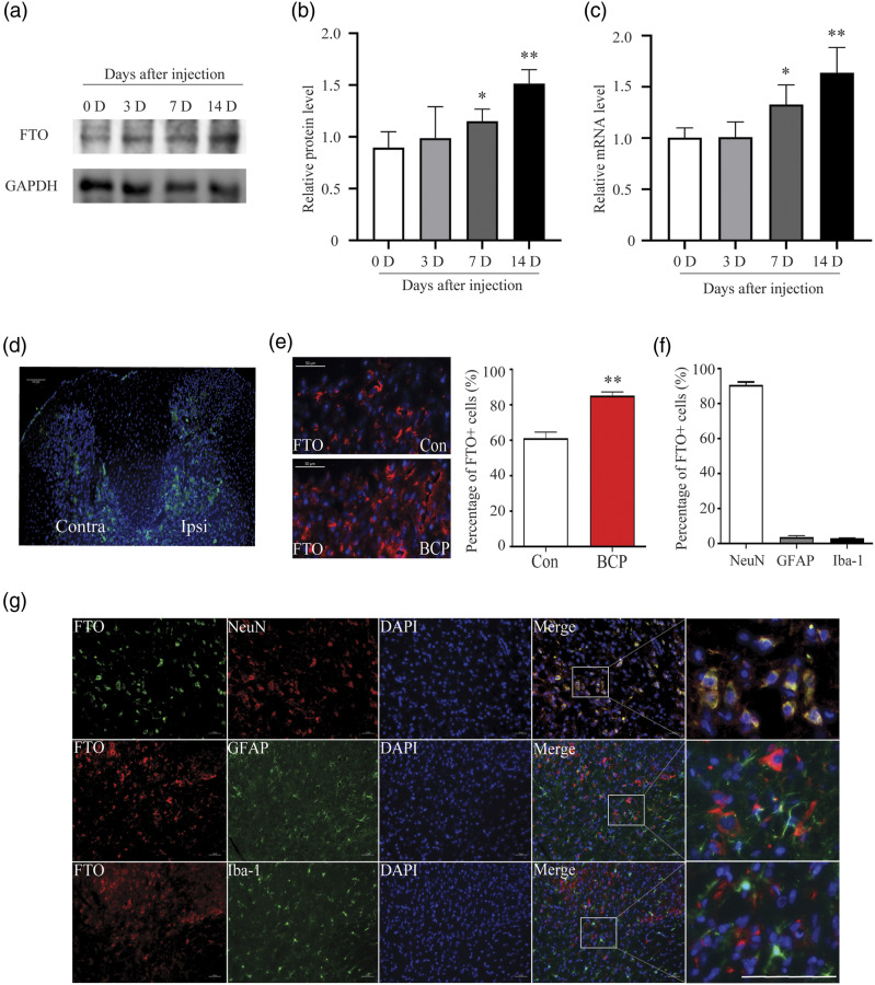 Fat mass and obesity-related protein contributes to the development and maintenance of bone cancer pain in rats by abrogating m6A methylation of RNA.