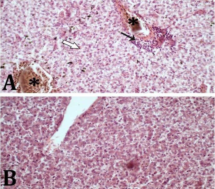 Protective effect of nanocurcumin on acetaminophen-induced hepatic and renal toxicities in pigeons.