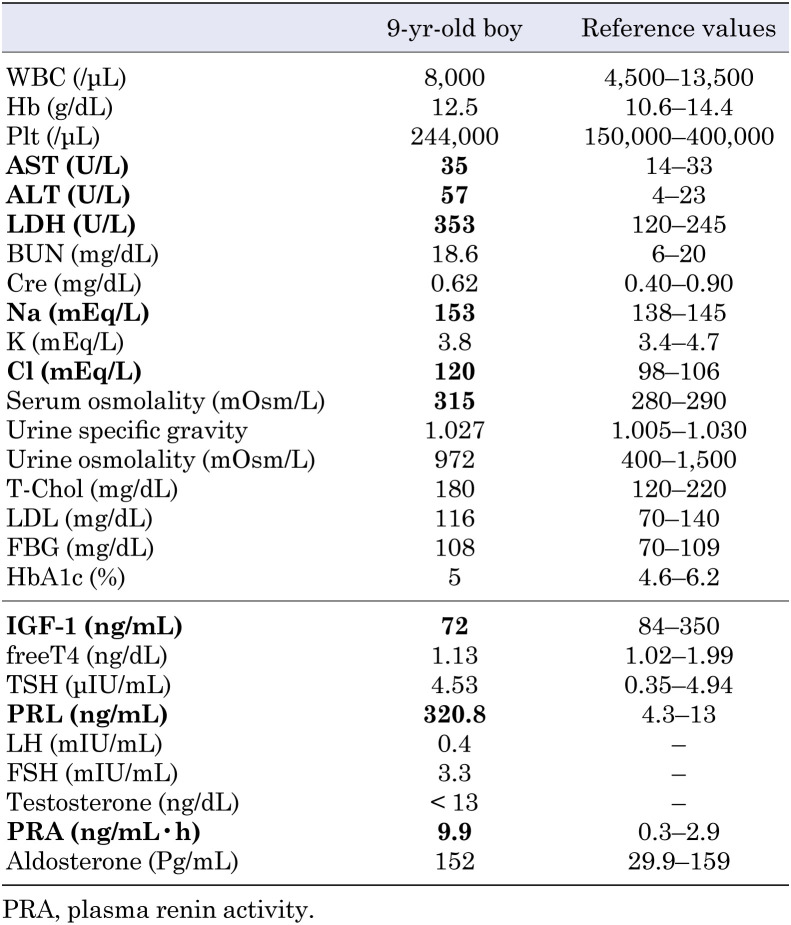 Adipsic hypernatremia with marked hyperprolactinemia and GH deficiency in a 9-year-old boy.