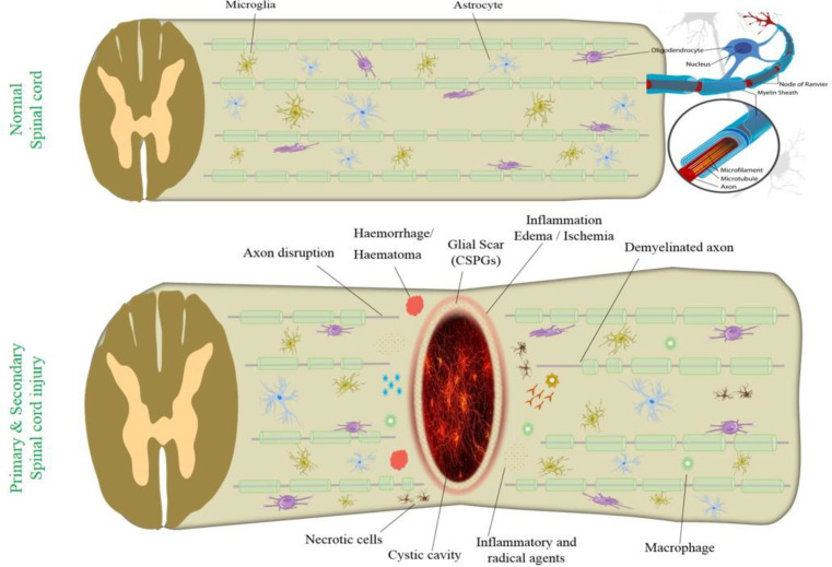 Recent Advances in the Treatment of Spinal Cord Injury.
