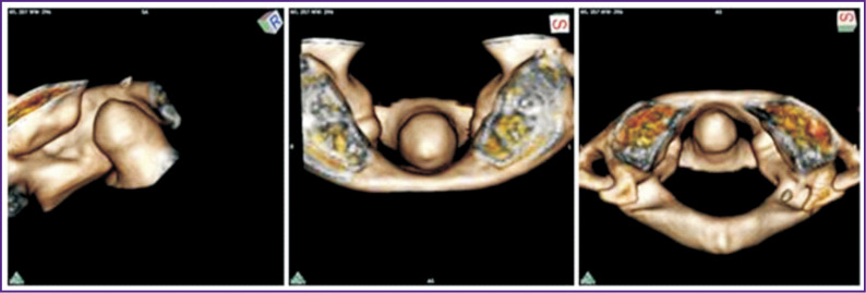 Experience of Using Neural Networks to Assess Age-Related Changes in Some Structures of the Skull and Cervical Vertebrae Based on CT Scans (Pilot Project).