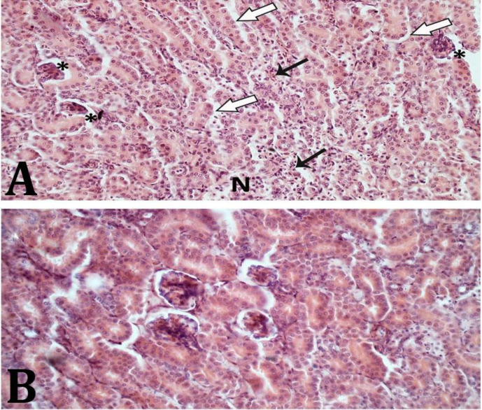 Protective effect of nanocurcumin on acetaminophen-induced hepatic and renal toxicities in pigeons.