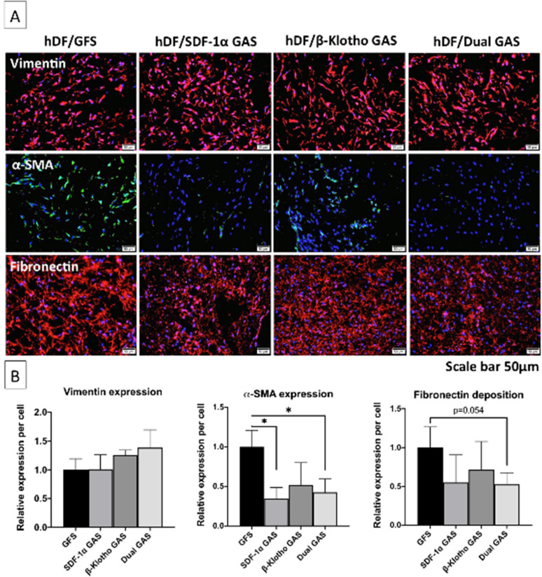 Dual delivery gene-activated scaffold directs fibroblast activity and keratinocyte epithelization.
