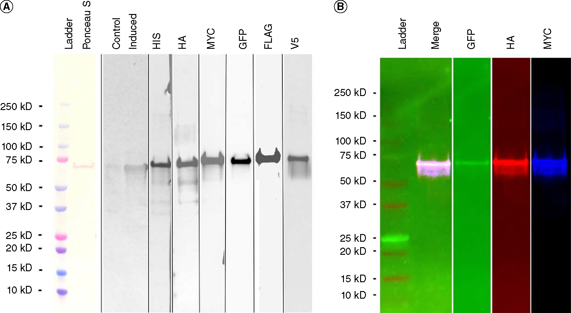 pJoseph2: a family of plasmids as positive controls for bacterial protein expression, transfections, and western blots.