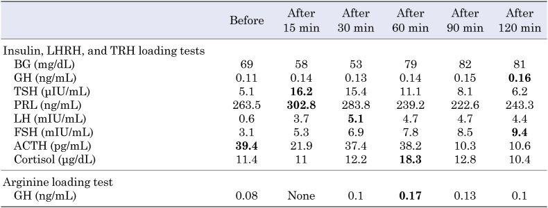 Adipsic hypernatremia with marked hyperprolactinemia and GH deficiency in a 9-year-old boy.