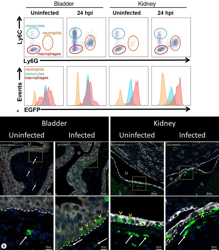 Murine Ribonuclease 6 Limits Bacterial Dissemination during Experimental Urinary Tract Infection.