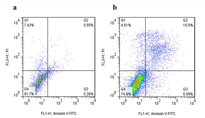 SiRNA-mediated Silencing of the RPS19 Gene Induces Apoptosis and Inhibits Cell Cycle Progression in Chronic Myeloid Leukemia Cells.