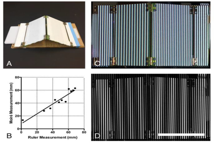 Quantitative Analysis of Scapular Winging Using Moire Topography.