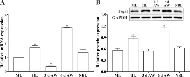 Galactomannan inhibits Trichinella spiralis invasion of intestinal epithelium cells and enhances antibody-dependent cellular cytotoxicity related killing of larvae by driving macrophage polarization.