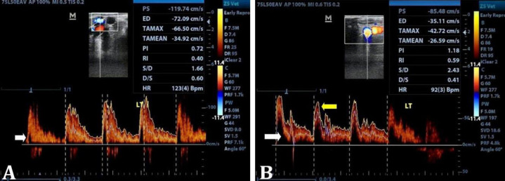 Temporal alteration in ovarian follicle fate with hormonal and hemodynamic perspectives during receptive phase of estrous cycle in endometritic cattle.