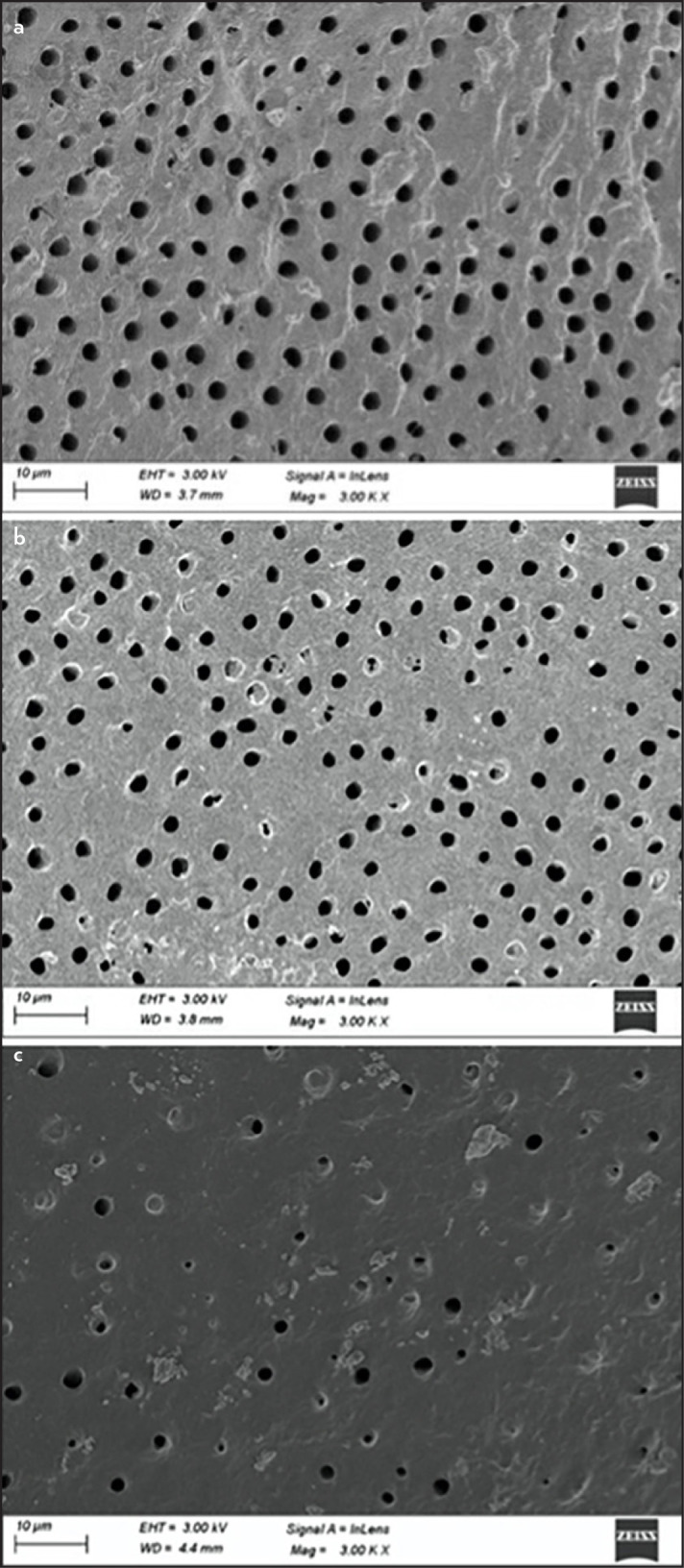 Comparative Evaluation of the Effect of Different Chelating Agents on Mineral Content and Erosion of Radicular Dentine: A FESEM-EDS Analysis.
