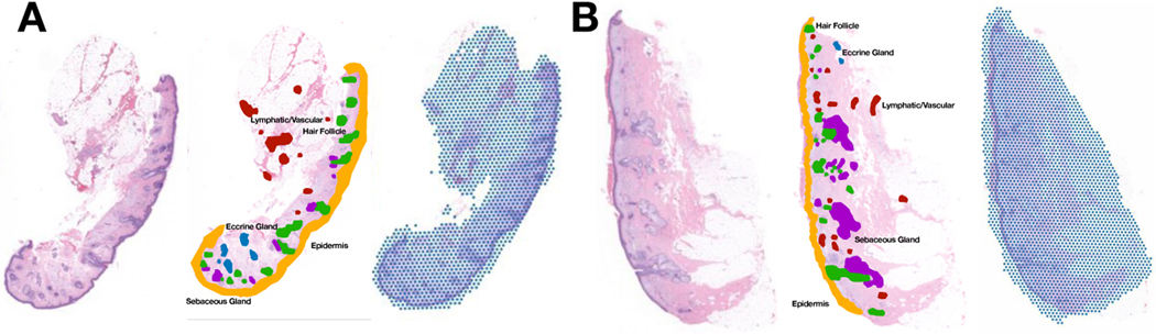 Potential to Enhance Large Scale Molecular Assessments of Skin Photoaging through Virtual Inference of Spatial Transcriptomics from Routine Staining.
