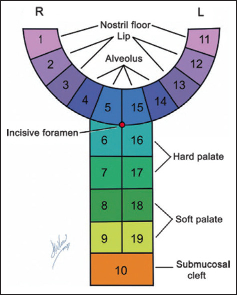Comparative Study between Modified Millard and White Roll Vermilion Flap Techniques in Unilateral Lip Repair: A Randomised Controlled Study.
