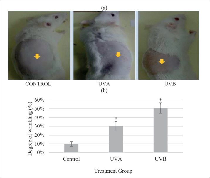 Comparison of UVA vs UVB Photoaging Rat Models in Short-term Exposure.