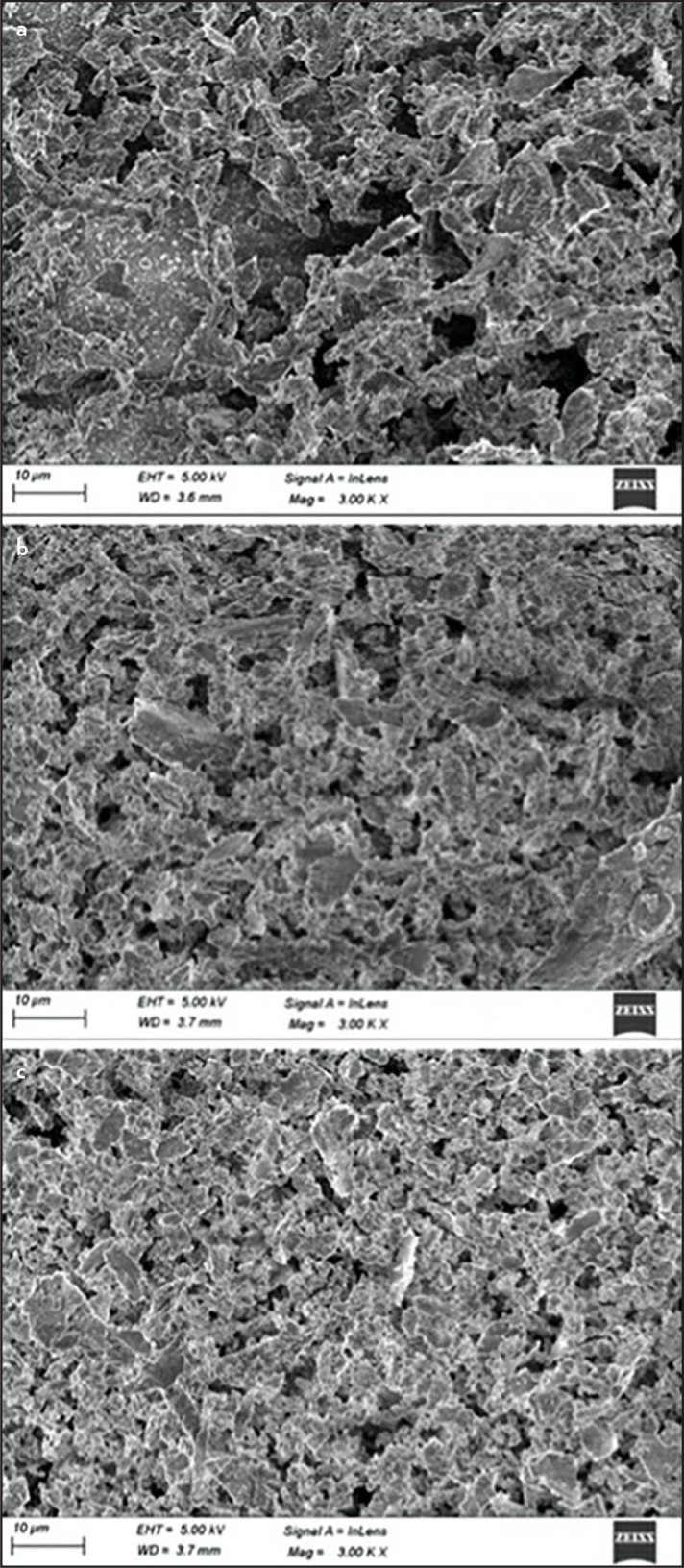 Comparative Evaluation of the Effect of Different Chelating Agents on Mineral Content and Erosion of Radicular Dentine: A FESEM-EDS Analysis.