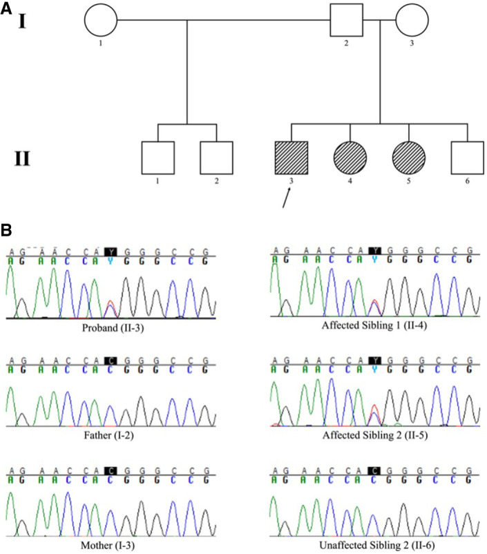 <i>ITPR1</i>-associated spinocerebellar ataxia with craniofacial features-additional evidence for germline mosaicism.