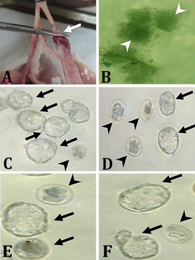 Effect of nanocurcumin on fertility in murine model of polycystic ovary syndrome.