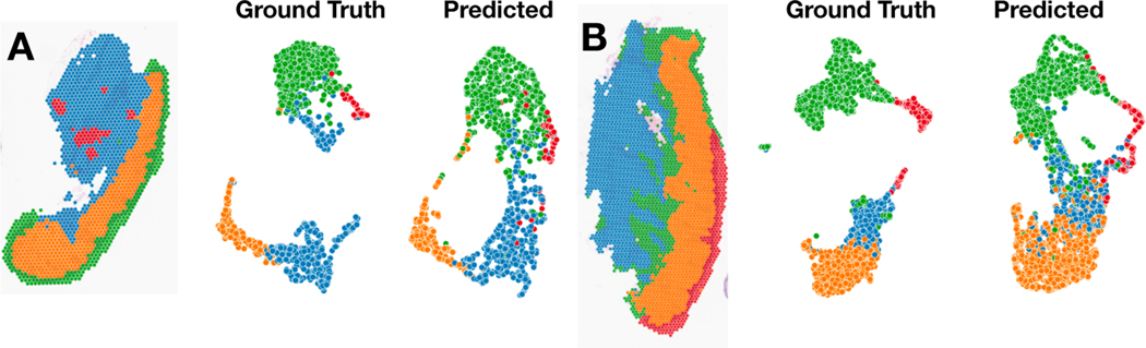 Potential to Enhance Large Scale Molecular Assessments of Skin Photoaging through Virtual Inference of Spatial Transcriptomics from Routine Staining.