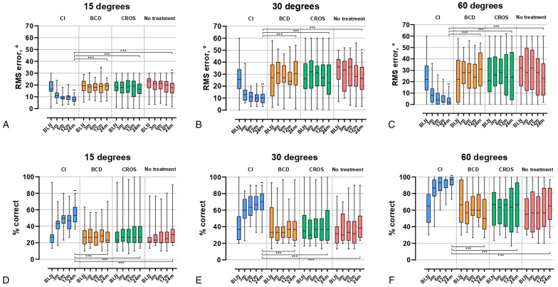 Sound Localization in Single-Sided Deafness; Outcomes of a Randomized Controlled Trial on the Comparison Between Cochlear Implantation, Bone Conduction Devices, and Contralateral Routing of Signals Hearing Aids.