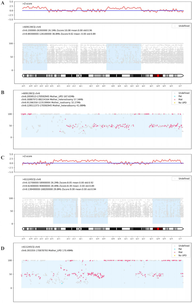 Maternal uniparental disomy for chromosome 6 in 2 prenatal cases with IUGR: case report and literature review.
