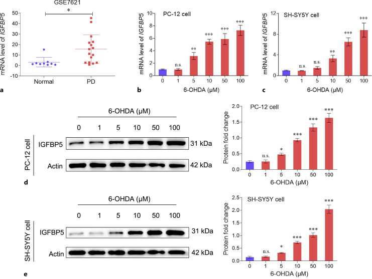 IGFBP5 Promotes Neuronal Apoptosis in a 6-OHDA-Toxicant Model of Parkinson's Disease by Inhibiting the Sonic Hedgehog Signaling Pathway.