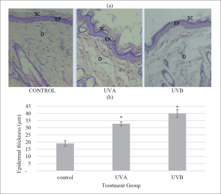 Comparison of UVA vs UVB Photoaging Rat Models in Short-term Exposure.