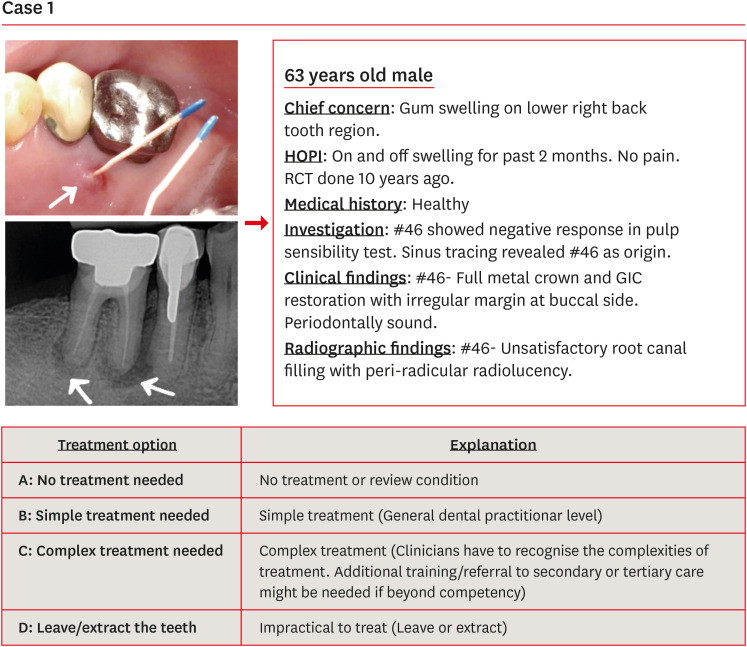 Effect of Dental Practicality Index training using an online video on decision-making and confidence level in treatment planning by dental undergraduates.