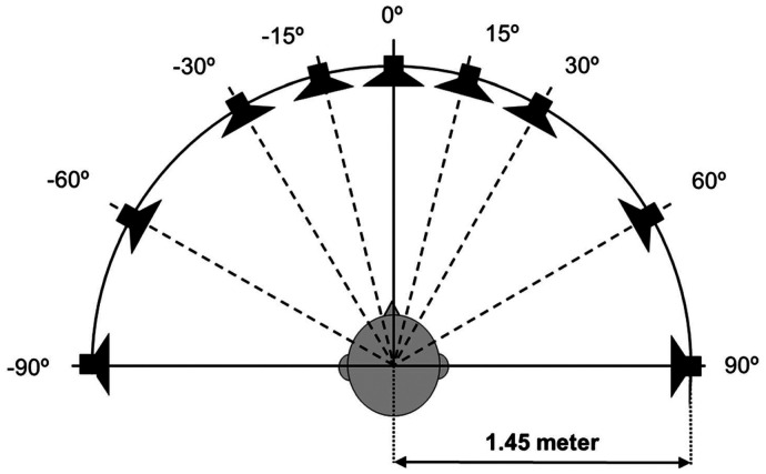 Sound Localization in Single-Sided Deafness; Outcomes of a Randomized Controlled Trial on the Comparison Between Cochlear Implantation, Bone Conduction Devices, and Contralateral Routing of Signals Hearing Aids.
