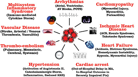 "When," "Where," and "How" of SARS-CoV-2 Infection Affects the Human Cardiovascular System: A Narrative Review.