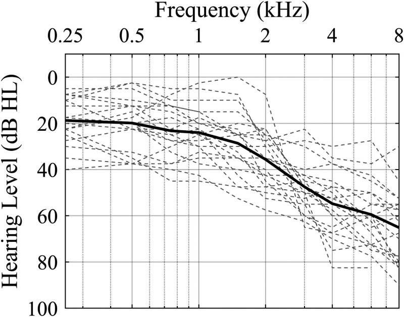 Individual Differences Underlying Preference for Processing Delay in Open-Fit Hearing Aids.