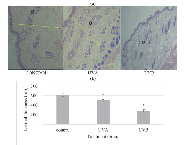 Comparison of UVA vs UVB Photoaging Rat Models in Short-term Exposure.