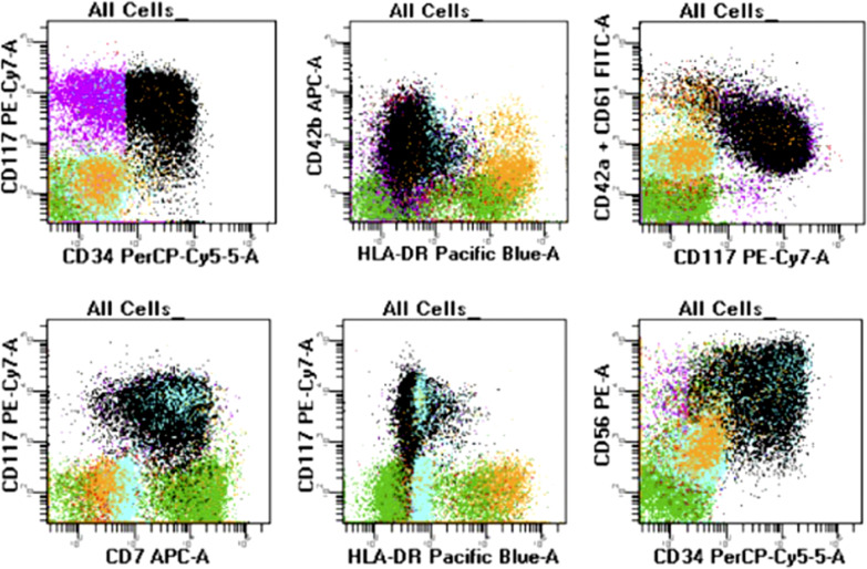 Myeloid Proliferations Associated with Down Syndrome: Clinicopathologic Characteristics of Forty Cases from Five Large Academic Institutions.