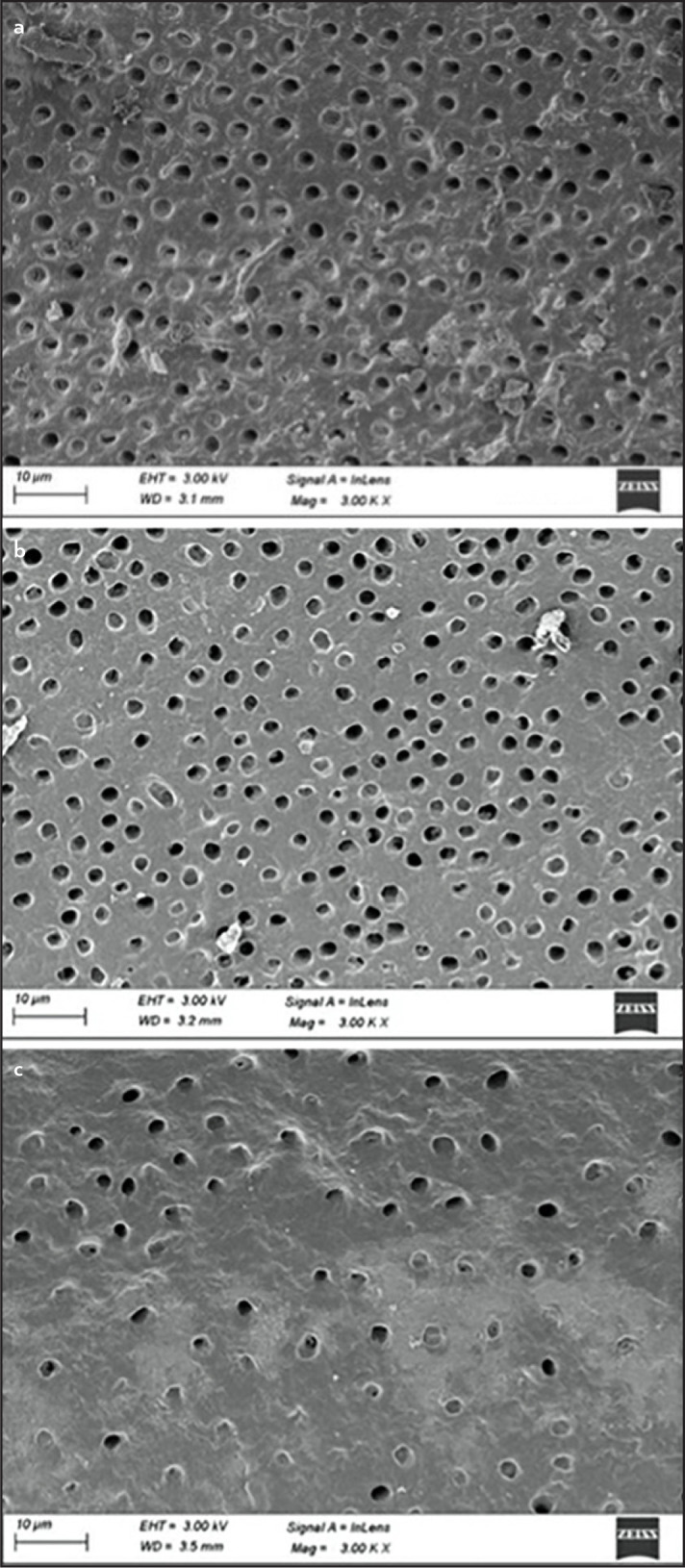 Comparative Evaluation of the Effect of Different Chelating Agents on Mineral Content and Erosion of Radicular Dentine: A FESEM-EDS Analysis.