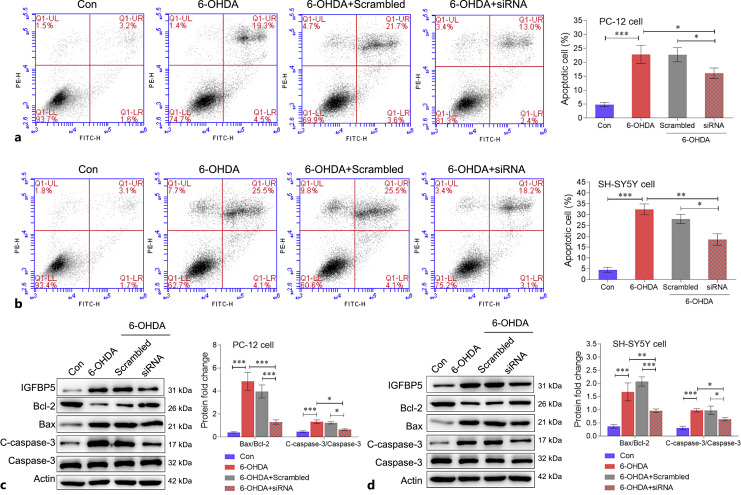 IGFBP5 Promotes Neuronal Apoptosis in a 6-OHDA-Toxicant Model of Parkinson's Disease by Inhibiting the Sonic Hedgehog Signaling Pathway.