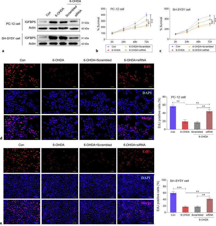 IGFBP5 Promotes Neuronal Apoptosis in a 6-OHDA-Toxicant Model of Parkinson's Disease by Inhibiting the Sonic Hedgehog Signaling Pathway.