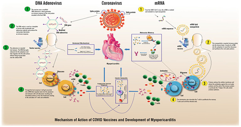 Is There a Causal Link Between Acute Myocarditis and COVID-19 Vaccination: An Umbrella Review of Published Systematic Reviews and Meta-Analyses.