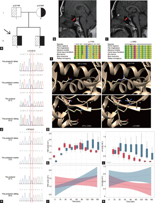Identification of two compound heterozygous GNRHR mutations in two siblings with congenital hypogonadotropic hypogonadism.