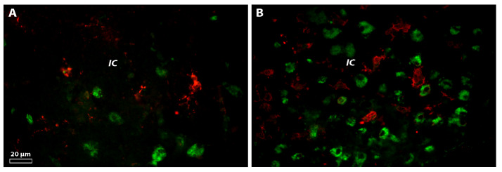 The Impact of Juvenile Microglia Transcriptomics on the Adult Brain Regeneration after Cerebral Ischemia.