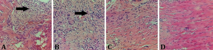 Effect of curcumin-loaded polycaprolactone scaffold on Achilles tendon repair in rats.