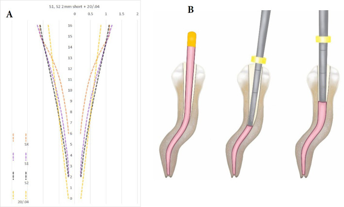 Enhancing Coronal Adaptation of Root Canal Fillings with a Modified Single-Cone Obturation Technique: Two Case Reports.